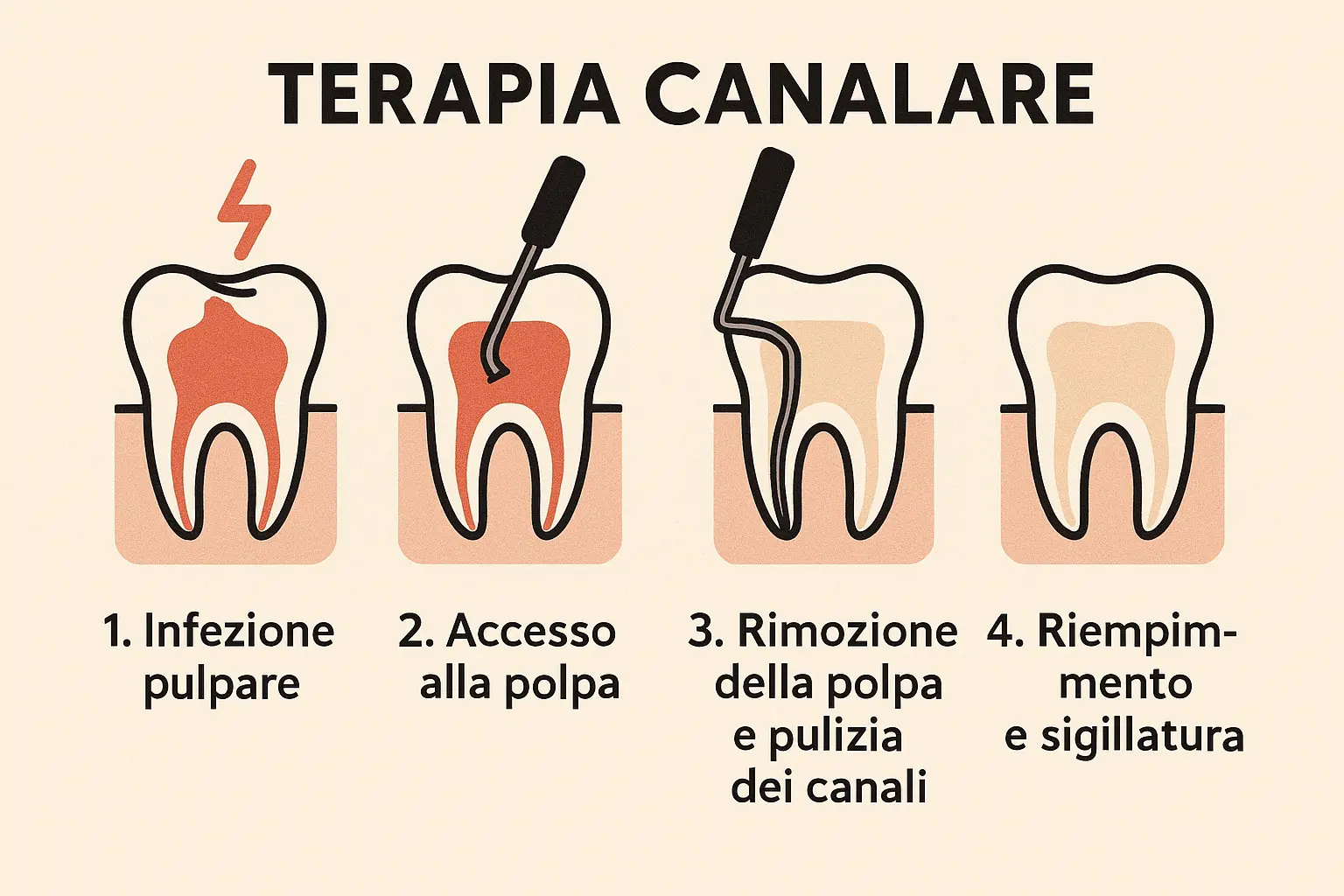 Terapia canalare